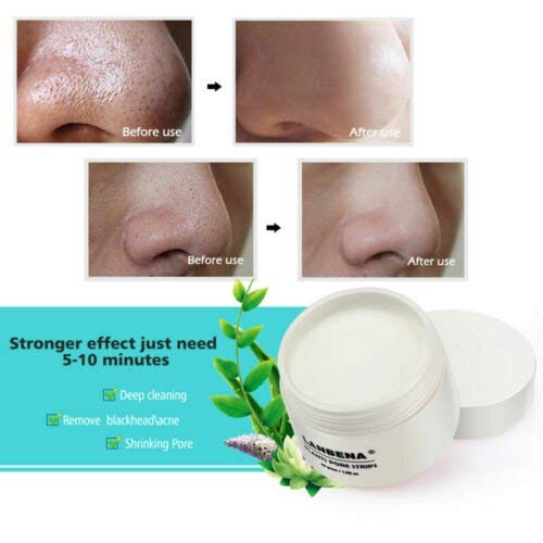 Original LANBENA Blackhead Remover Cream